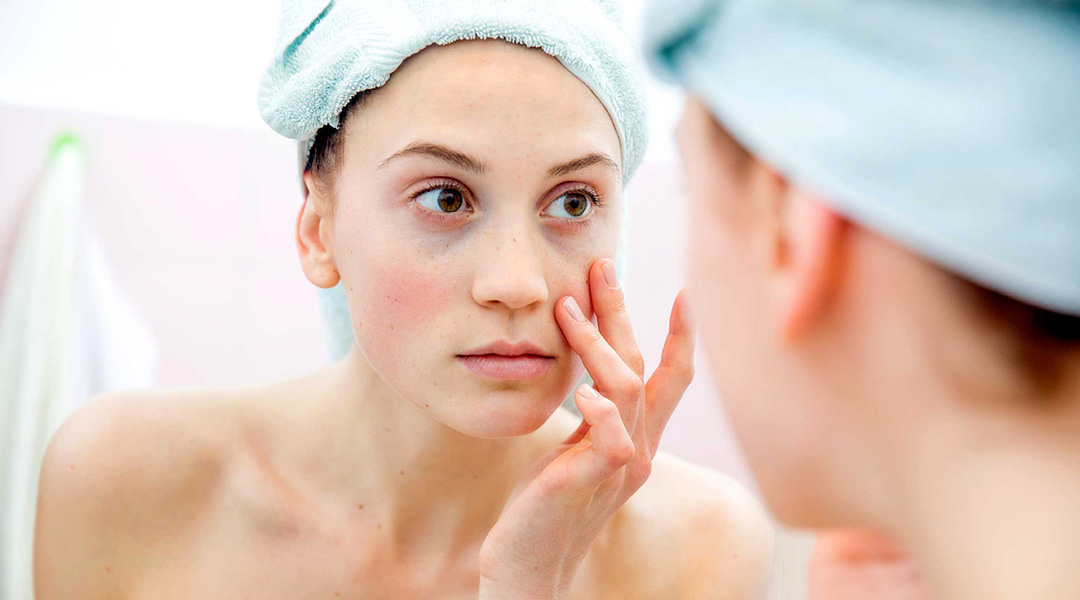 Cause Of Dark Circles The Health Blog Fidoc